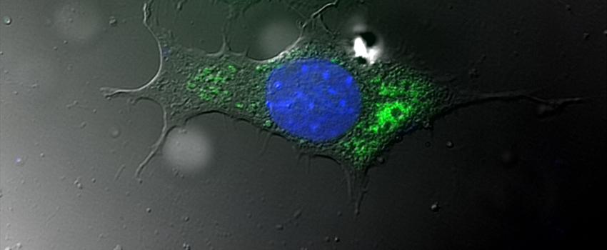 DIC和荧光显微镜图像叠加显示整个宿主细胞(灰色，细胞核蓝色)和细胞内细菌(绿色)。.