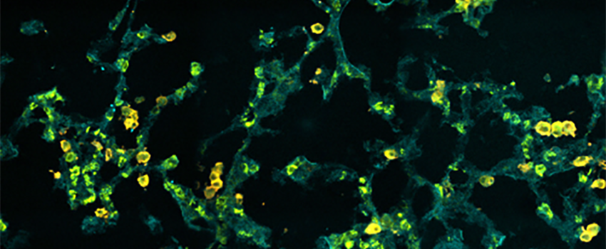 低温保存小鼠肺内肺泡腔的免疫染色.  共聚焦高光谱显微镜拍摄的图像.