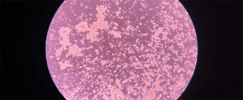 小鼠颈部淋巴结5微米切片的共聚焦显微镜图像，免疫染色B细胞, T细胞和树突状细胞.